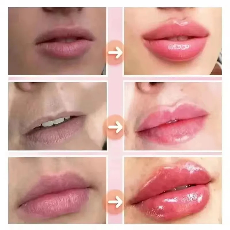 Instant Lip Plumping Essential - Lip Gloss Plumping review and price