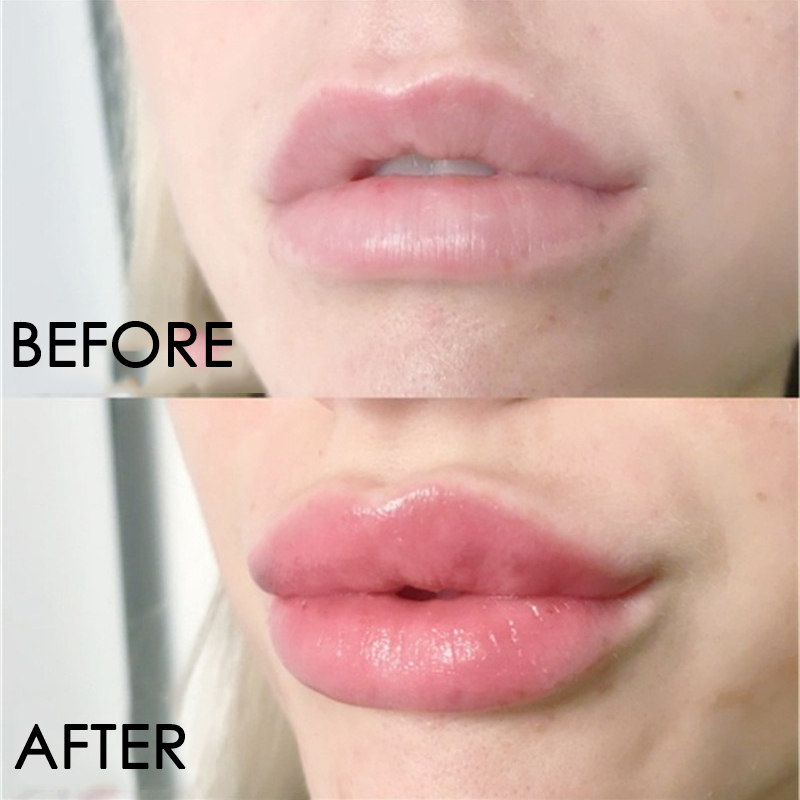 Lip Care Serum Instant Volumis - Lip Gloss Plumping review and price